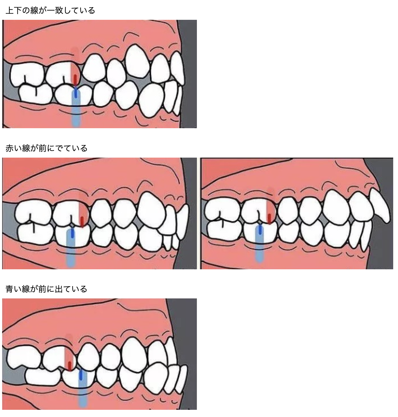 矯正 ゴム かけ いつから