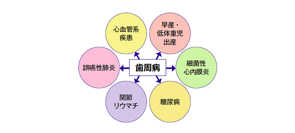 歯周病と全身疾患